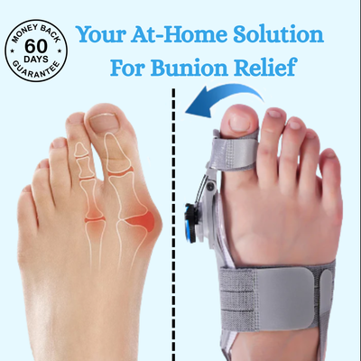 Treatremedy Bunion fix