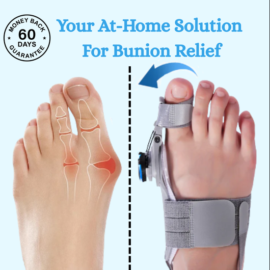 Treatremedy Bunion fix